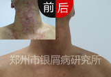 淶ƣʮ̼